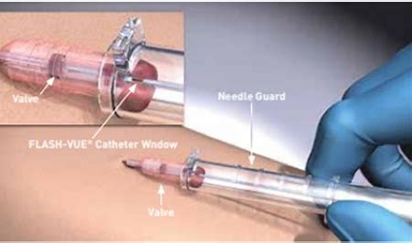 ViaValve Safety IV Catheter W/Blood Control, 16G x 1.25in
